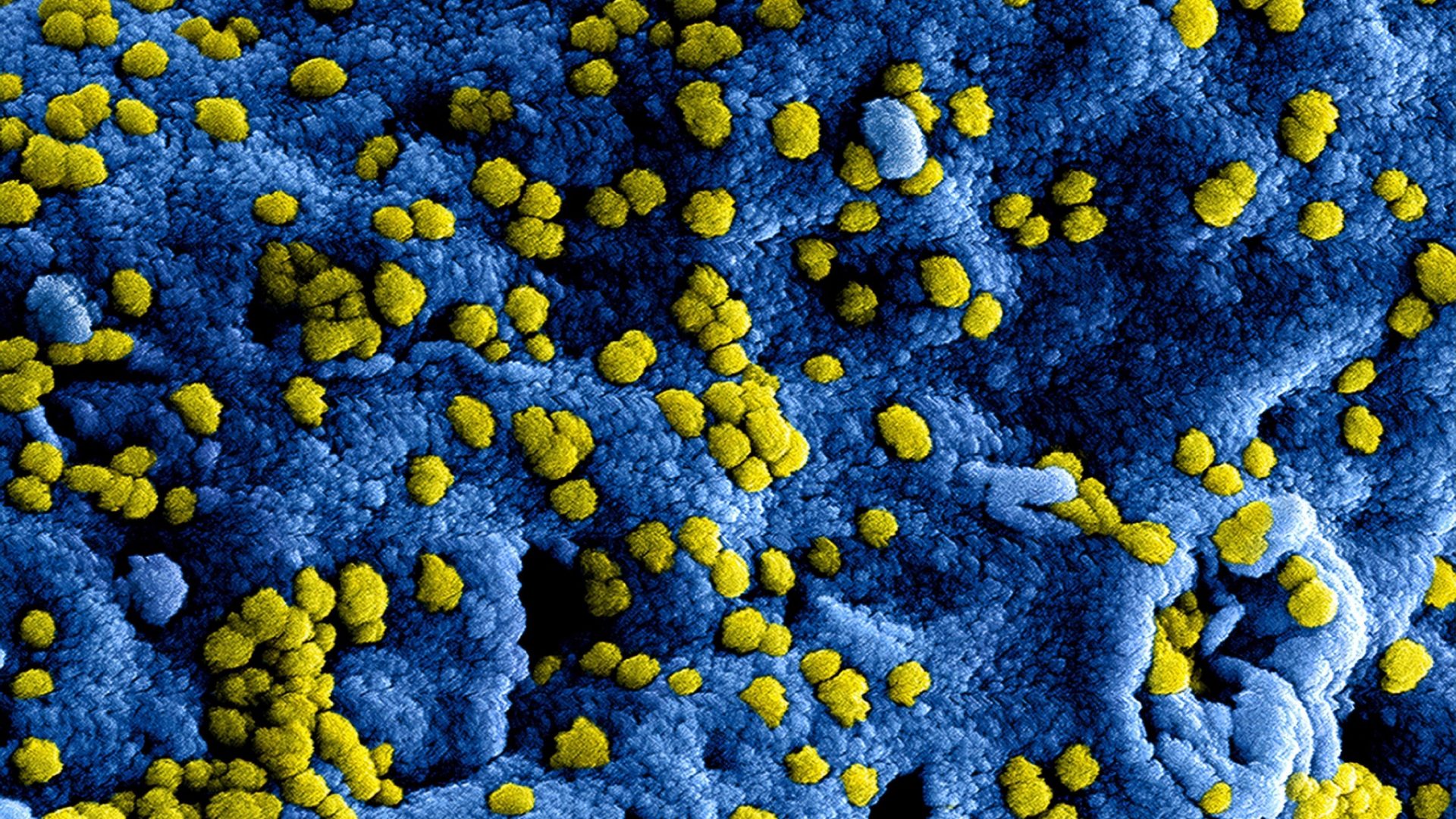 Afbeelding van een Coronavirus, gemaakt door het CDC (US Center for Disease Control), via Unsplash.